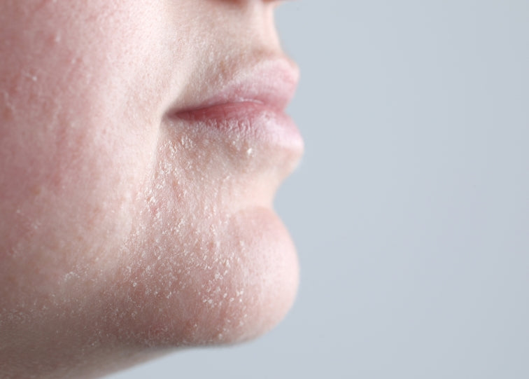 Why Dry Skin Can Make You Appear Older (and How to Fix It)