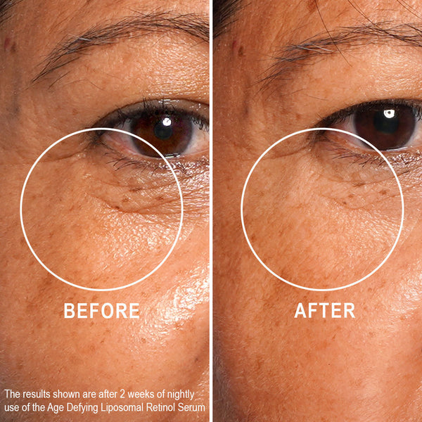 Age Defying Liposomal Retinol Serum