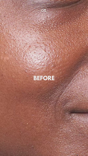 Hyaluronic Peptide Serum Before and Afters